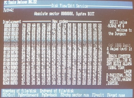 Das Brain-Virus