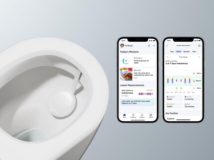 Das neun Zentimeter grosse Gerät wird etwa 500 Euro kosten.