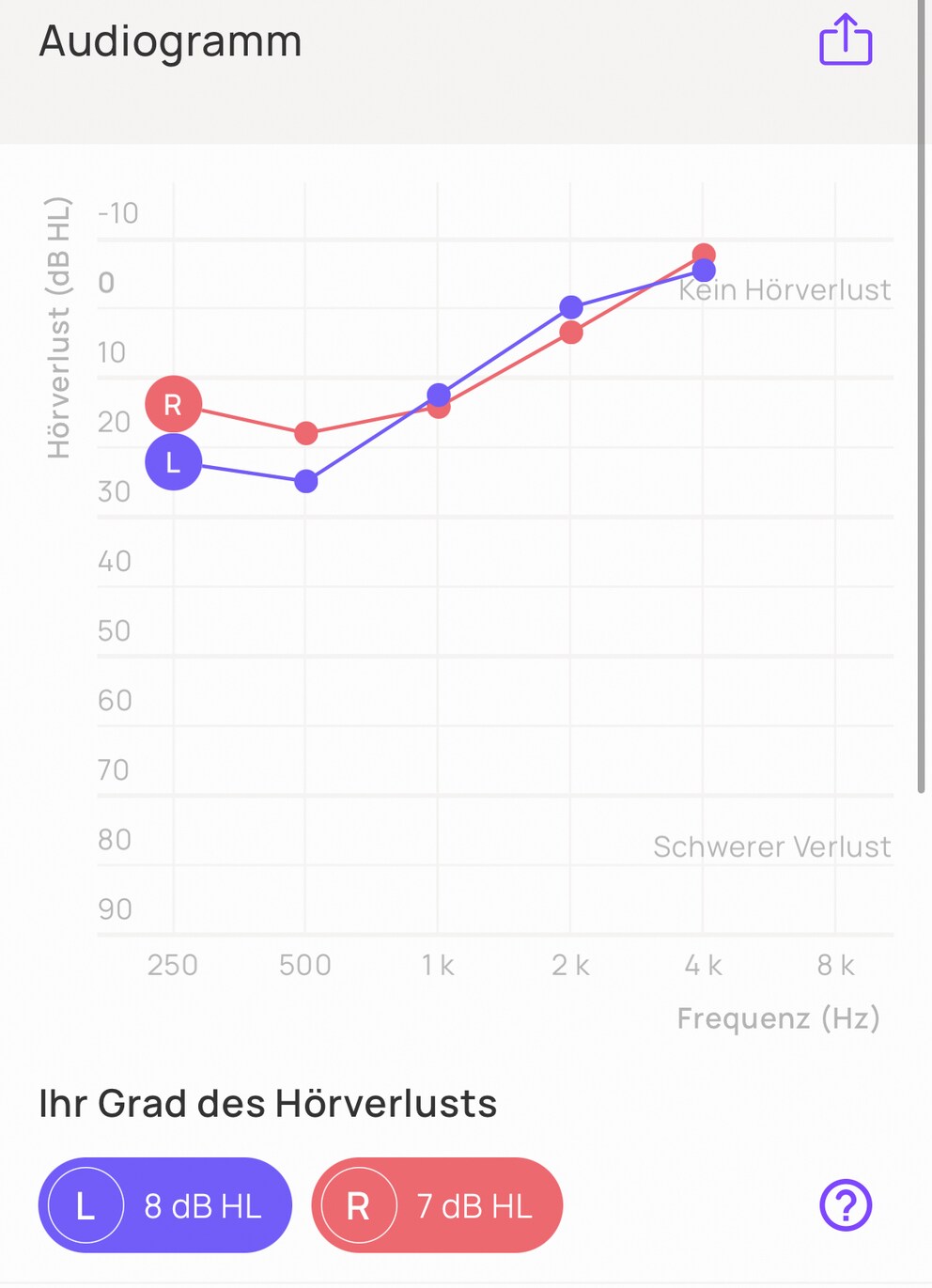 In welchem Bereich gibts Probleme? Das Audiogramm zeigts an.