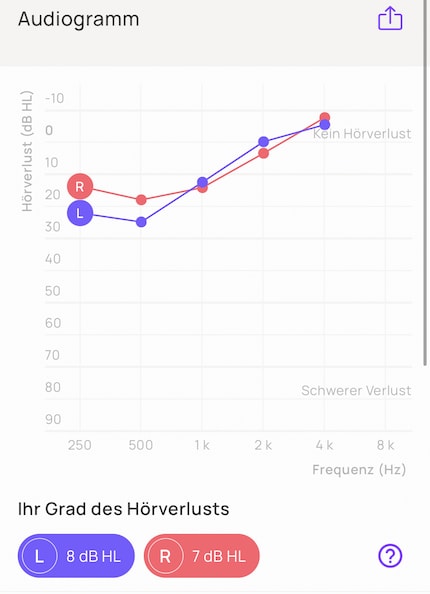 In welchem Bereich gibts Probleme? Das Audiogramm zeigts an.