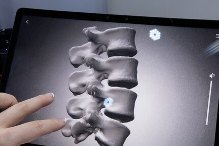 Il nubia Pad 3D II ha una visualizzazione 3D migliorata, ad esempio per i modelli ossei.