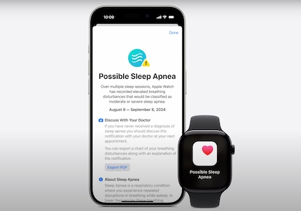 Se l'Apple Watch misura troppe interruzioni respiratorie in una notte, visualizza un avviso. 